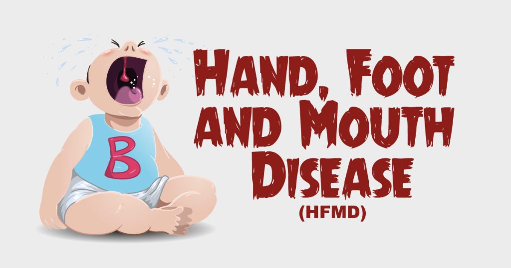 Flu Singapore atau Hand, Foot, and Mouth Disease (HFMD)